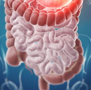 Crohn-Hastalığı